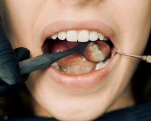dental emergency